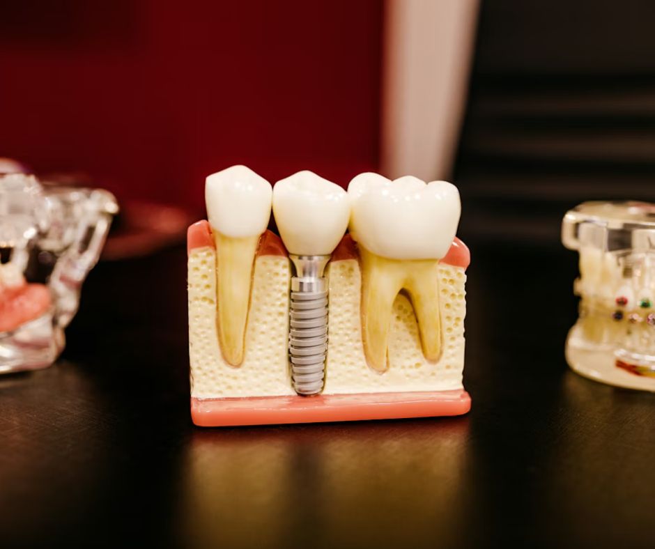 Dental Spain vs Portugal